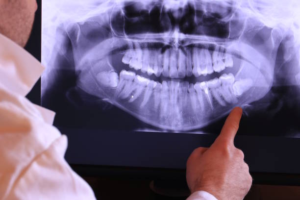 24-Hour Dental Clinic Near Me in LA