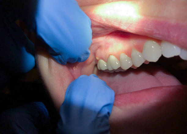 Emergency Dentist for Kids in LA